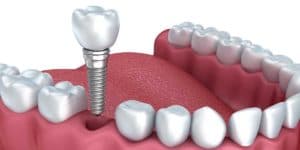 Restorative Dentistry